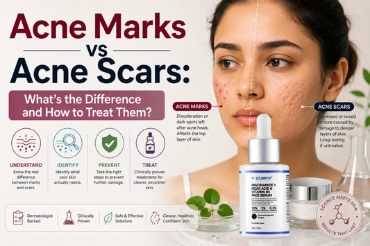 Acne marks vs acne scars comparison with QTWAYS Niacinamide, Kojic Acid & Vitamin B5 Face Serum explaining the difference, causes, and clinically proven treatment for clearer skin.