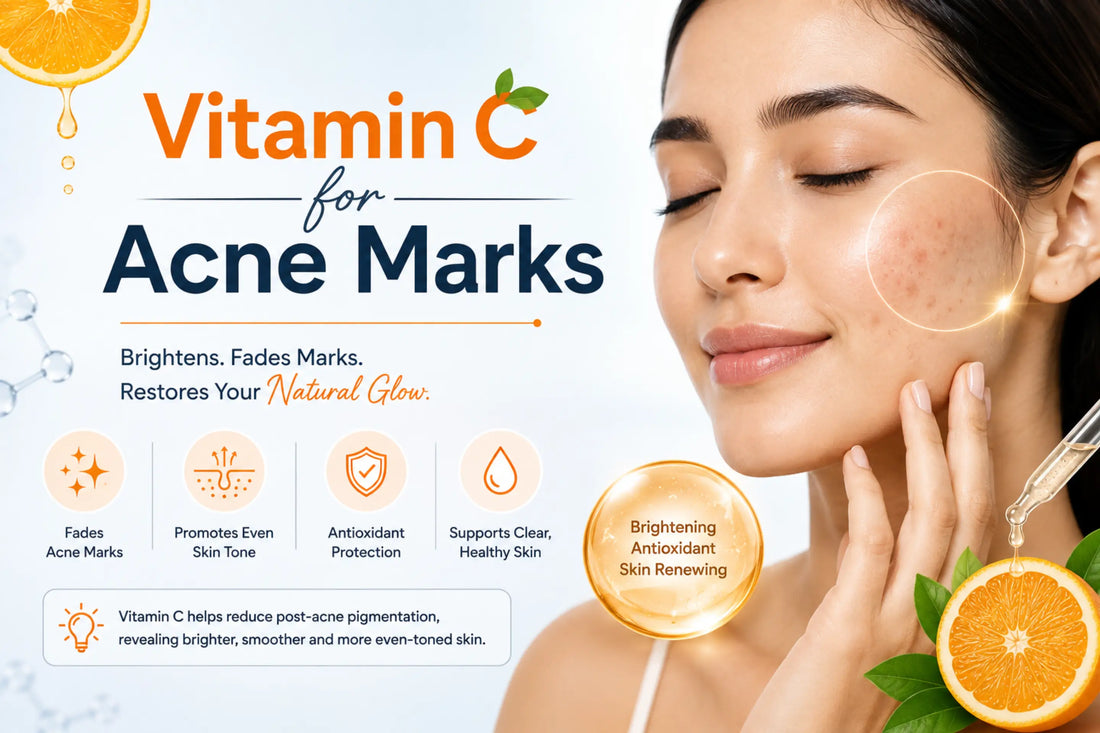 Vitamin C for acne marks, showing skincare serum and benefits for fading dark spots and evening skin tone.