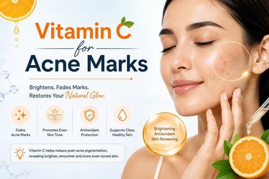 Vitamin C for acne marks, showing skincare serum and benefits for fading dark spots and evening skin tone.