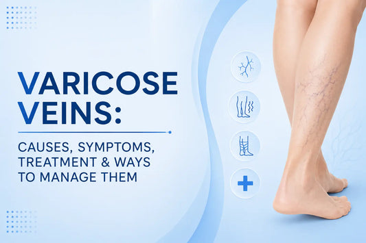 Varicose veins causes, symptoms, treatment and management illustrated with a medical leg showing visible enlarged veins