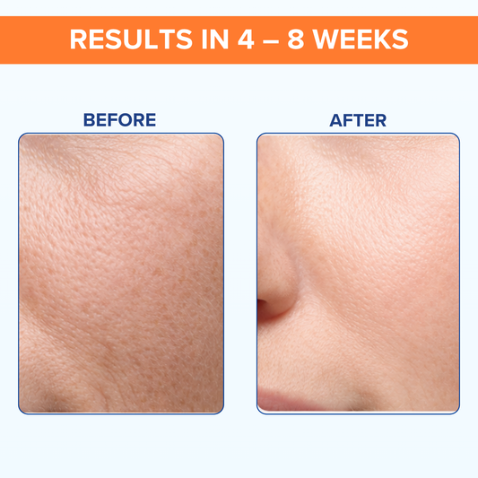 QTWAYS 0.3% Retinol Serum with Bakuchiol & Vitamin B5 | 30ml