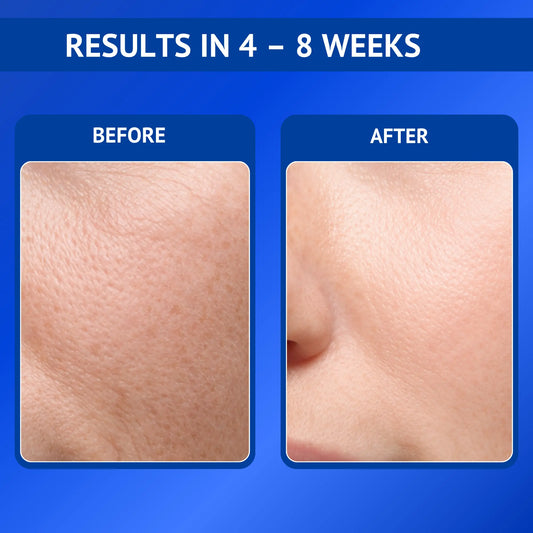0.3% Retinol Serum with Bakuchiol & Vitamin B5