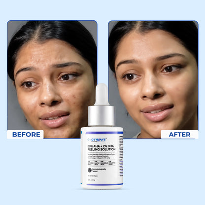 30% AHA + 2% BHA Peeling Solution with D-Panthenol