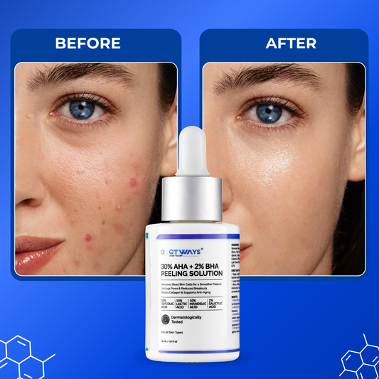 QTWAYS 30 percent AHA and 2 percent BHA Peeling Solution before and after results for clearer smoother glowing skin with reduced acne marks and refined texture