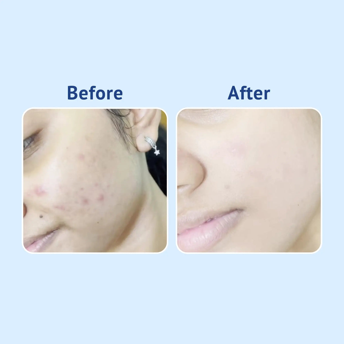 Vitamin C + E Gel Face Wash with Strawberry Extract & D-Panthenol