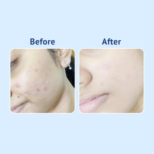 Vitamin C + E Gel Face Wash with Strawberry Extract & D-Panthenol