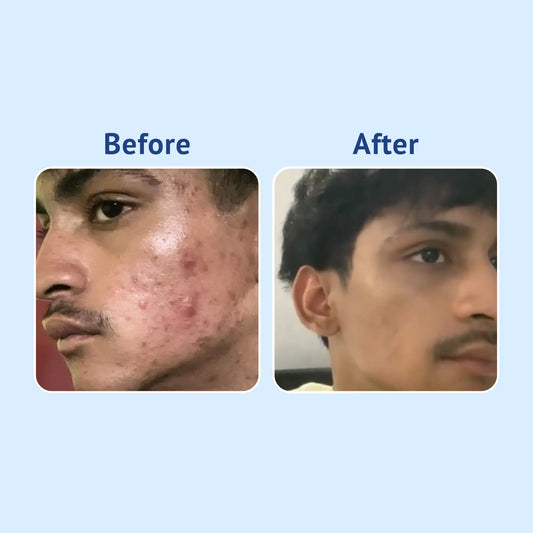 Vitamin C + E Gel Face Wash with Strawberry Extract & D-Panthenol