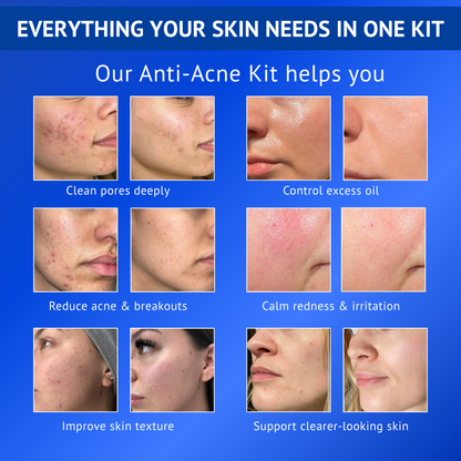 Anti-Acne Skincare Kit Combo
