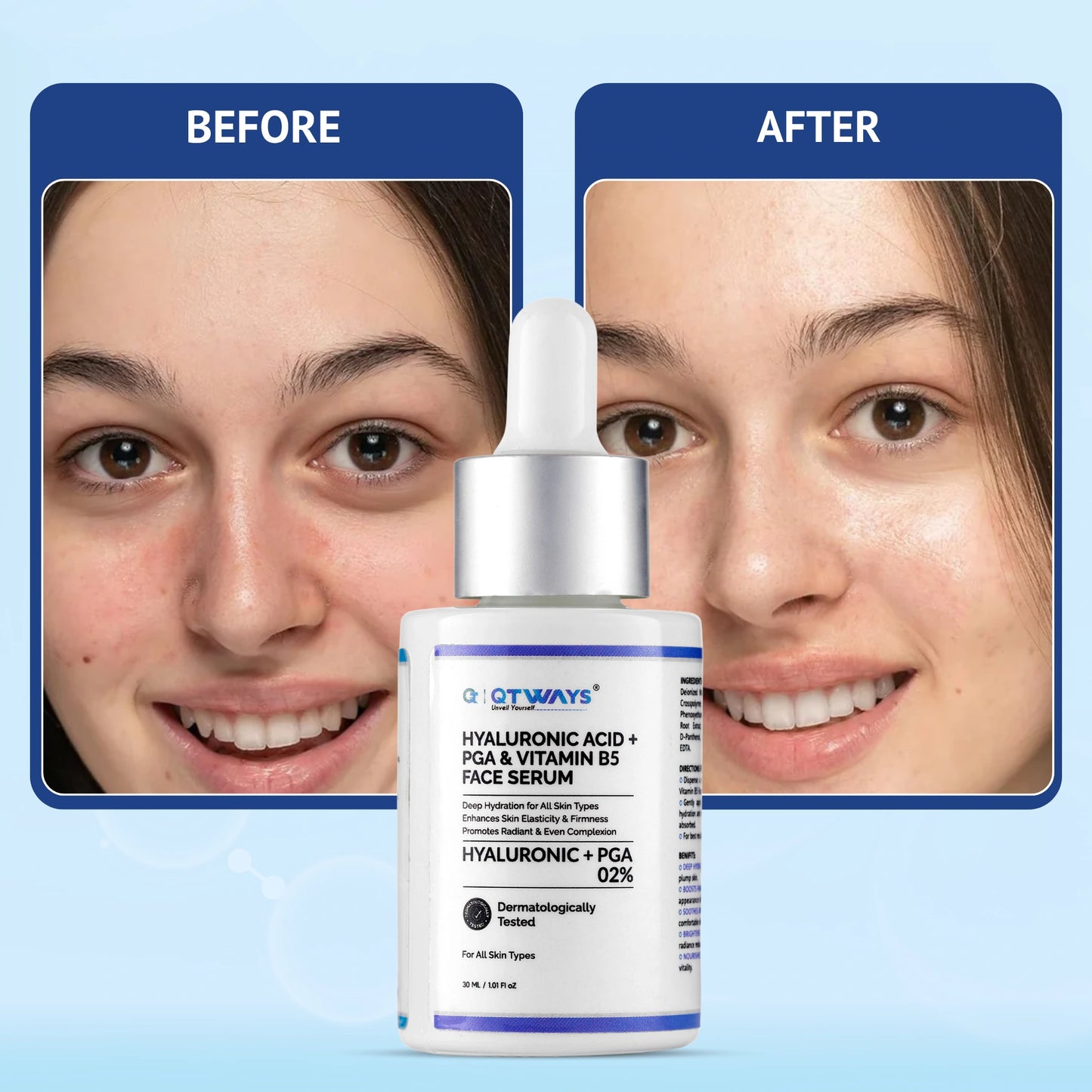 Before and after comparison side-by-side showing hydrated, plump, and radiant glowing skin with reduced redness after using QTWAYS Hyaluronic Acid + PGA & Vitamin B5 Face Serum in India.