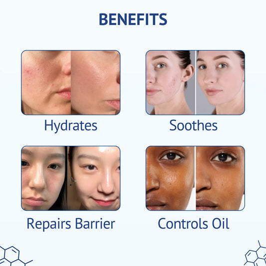 2% Hyaluronic Acid + PGA + Vitamin B5 Face Serum — 7-Active Deep Hydration with Soybean Ferment, Turmeric & Copper Peptide
