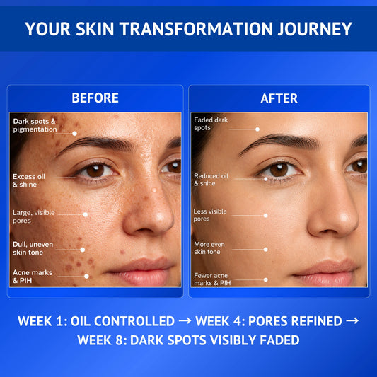 10% Niacinamide + 1% Kojic Acid & Vitamin B5 Serum