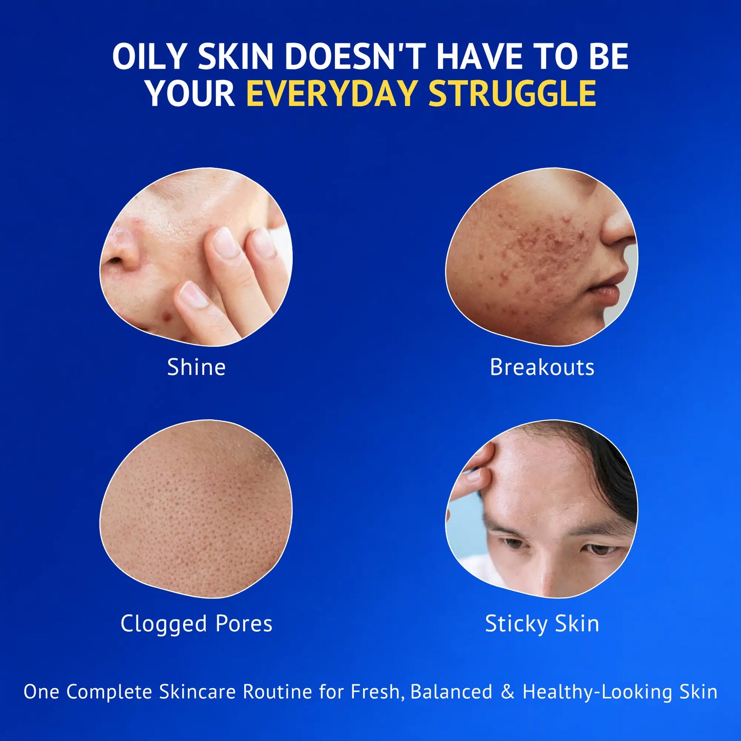 Infographic showing common oily skin concerns including excess shine, acne breakouts, clogged pores, and sticky skin with a complete skincare routine recommendation for fresh, balanced, and healthy-looking skin. Suitable for oily and acne-prone skin by QTWAYS.
oily skin
oily skin routine
oily skin problems
acne-prone skin
excess oil
clogged pores
skincare routine
healthy skin
QTWAYS