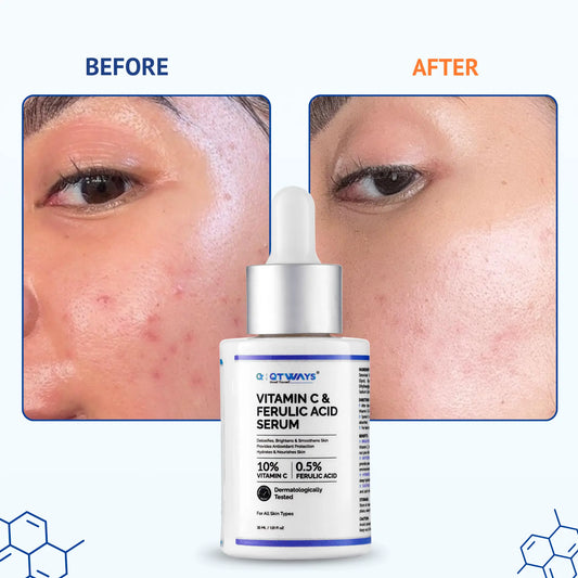 10% Vitamin C & 0.5% Ferulic Acid Brightening Serum — The Antioxidant Powerhouse for Glowing, Even-Toned Skin