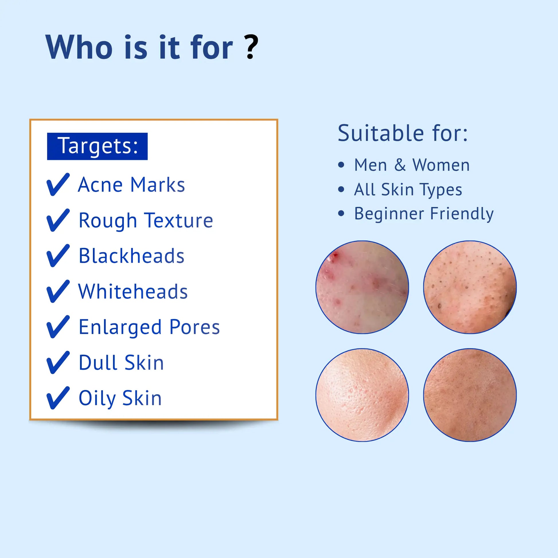 Infographic showing QTWAYS 30% AHA + 2% BHA Peeling Solution targets acne marks, rough texture, blackheads, whiteheads, enlarged pores, dull and oily skin, suitable for men, women, all skin types, and beginners.