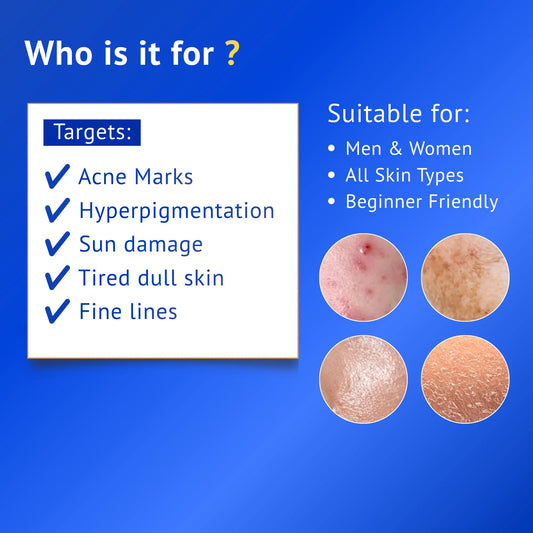 Informational QTWAYS skincare banner showing who Vitamin C & Ferulic Acid Serum is suitable for, targeting acne marks, hyperpigmentation, sun damage, dull skin, and fine lines. Suitable for men and women, all skin types, and beginners seeking brighter, healthier-looking skin.