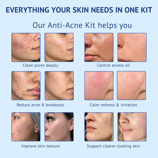 Benefits and transformation infographic titled Everything Your Skin Needs In One Kit for QTWAYS Anti-Acne Kit in India. It showcases 6 before-and-after skin visual pairs illustrating: Clean pores deeply, Control excess oil, Reduce acne & breakouts, Calm redness & irritation, Improve skin texture, and Support clearer-looking skin.