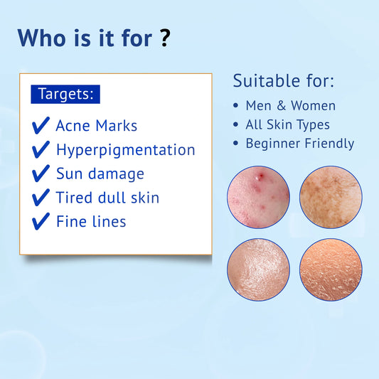 Infographic titled Who is it for showing suitability of QTWAYS Vitamin C & Ferulic Acid Serum in India: Targets acne marks, hyperpigmentation, sun damage, tired dull skin, and fine lines. Suitable for men and women, all skin types, and is beginner friendly.