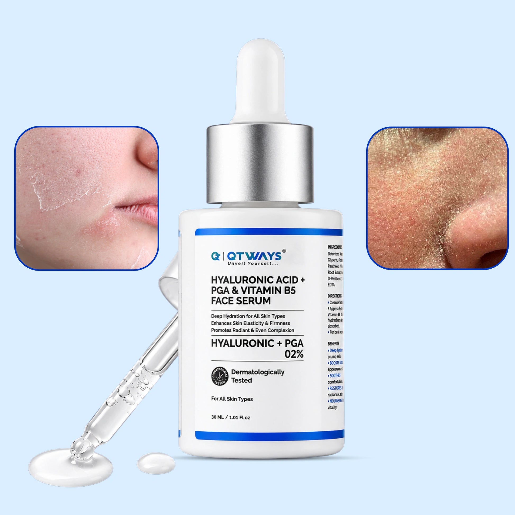 QTWAYS Hyaluronic Acid + PGA & Vitamin B5 Face Serum bottle with dropper in India, formulated with 2% Hyaluronic and Polyglutamic Acid, showcasing closeups of extremely dry, flaking, and dehydrated skin types requiring deep hydration.