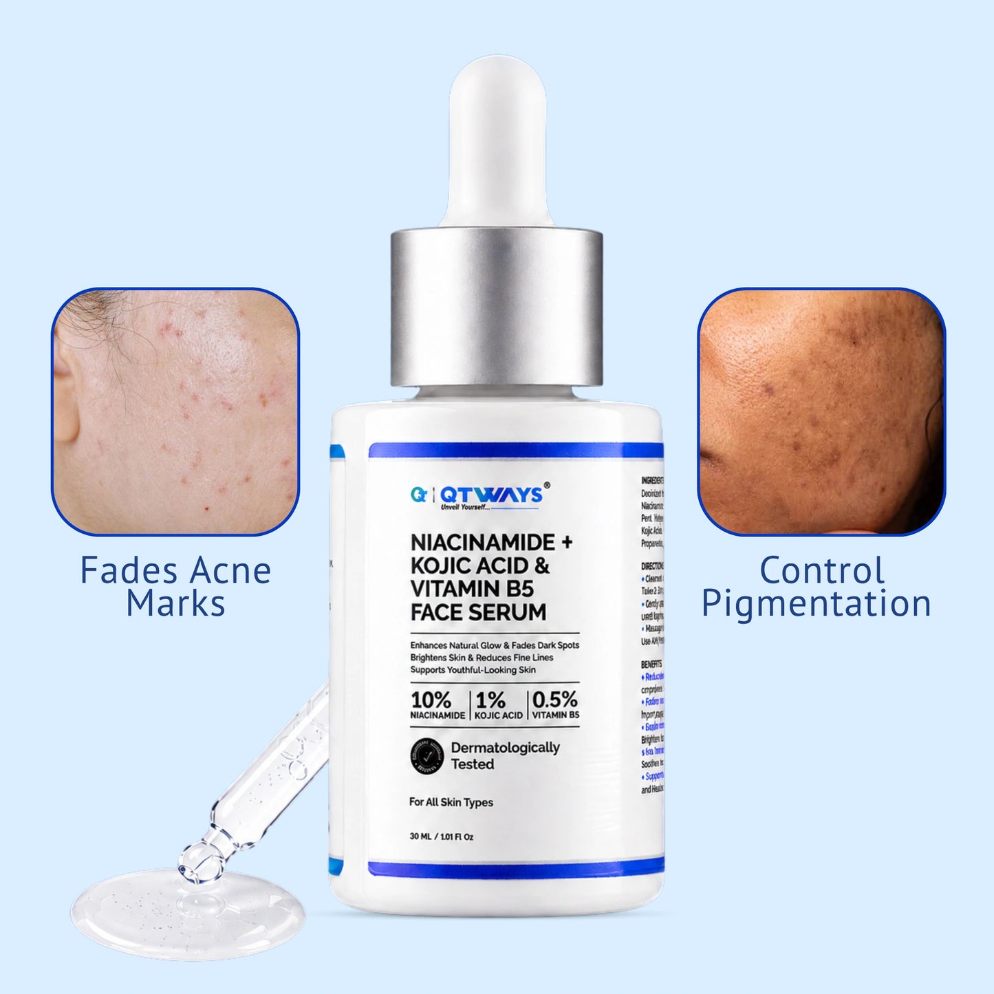 Infographic for QTWAYS Niacinamide + Kojic Acid & Vitamin B5 Face Serum in India, featuring the 30ml serum bottle and dropper with close-up visuals highlighting two major skin benefits: Fades Acne Marks and Control Pigmentation.