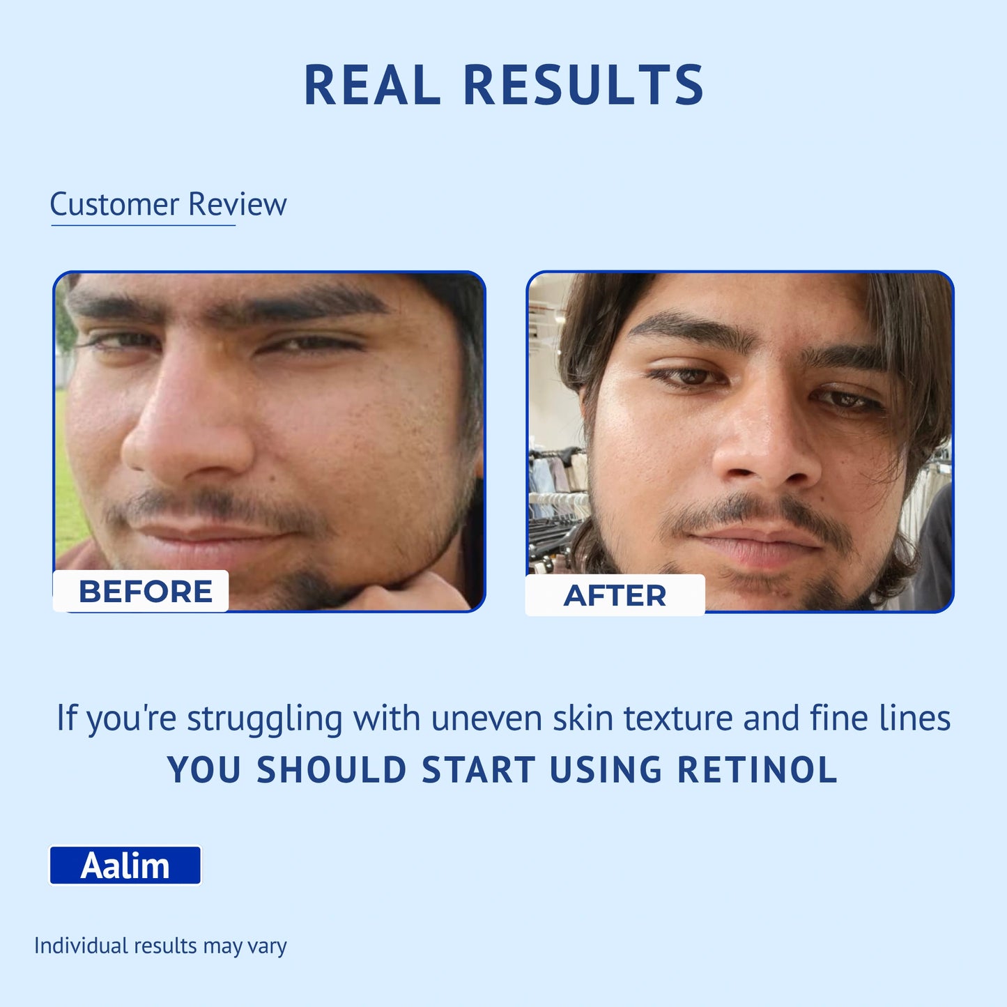 Customer review infographic titled Real Results for QTWAYS 0.3% Retinol Serum in India. It shows side-by-side Before and After facial photos of a male user named Aalim, highlighting improved skin texture and fine lines along with the recommendation: If you're struggling with uneven skin texture and fine lines YOU SHOULD START USING RETINOL.
