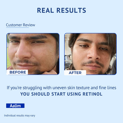 Customer review infographic titled Real Results for QTWAYS 0.3% Retinol Serum in India. It shows side-by-side Before and After facial photos of a male user named Aalim, highlighting improved skin texture and fine lines along with the recommendation: If you're struggling with uneven skin texture and fine lines YOU SHOULD START USING RETINOL.