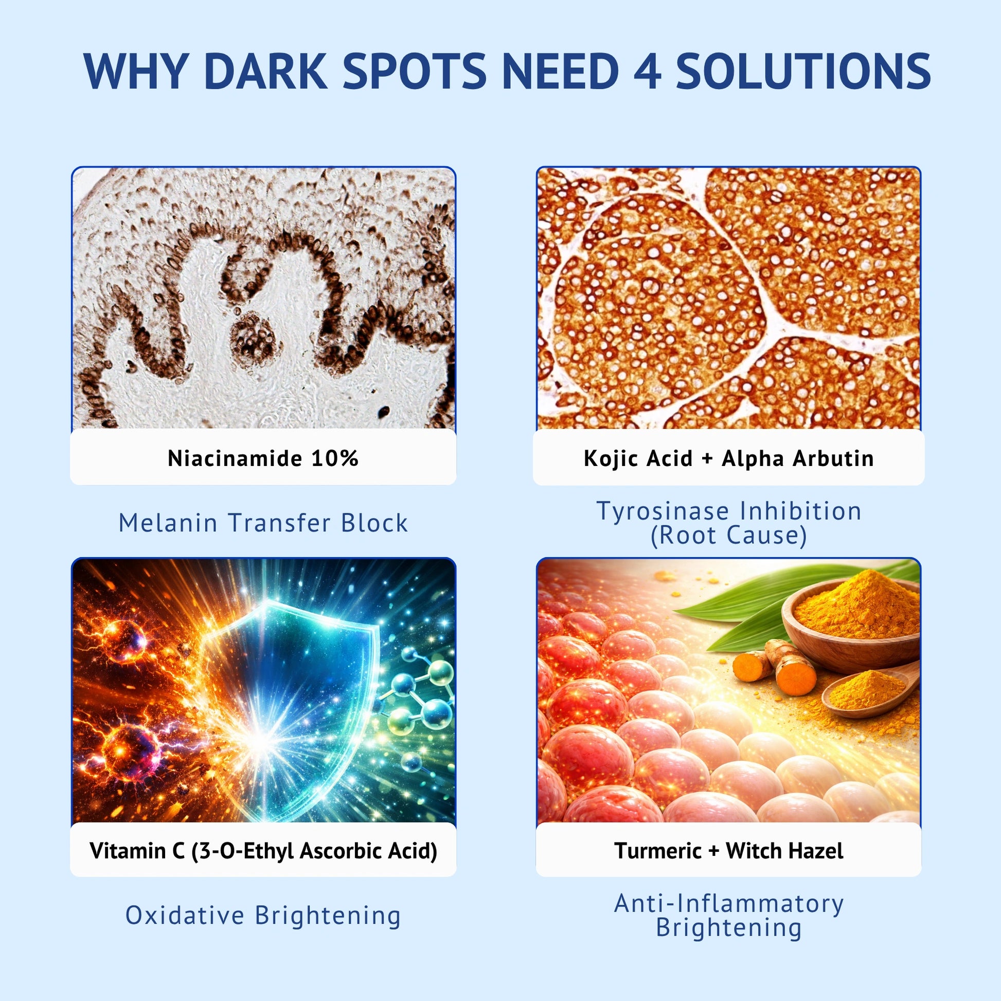 Educational infographic titled Why Dark Spots Need 4 Solutions by QTWAYS in India. It illustrates 4 key mechanisms: Niacinamide 10% for Melanin Transfer Block, Kojic Acid + Alpha Arbutin for Tyrosinase Inhibition, Vitamin C (3-O-Ethyl Ascorbic Acid) for Oxidative Brightening, and Turmeric + Witch Hazel for Anti-Inflammatory Brightening.