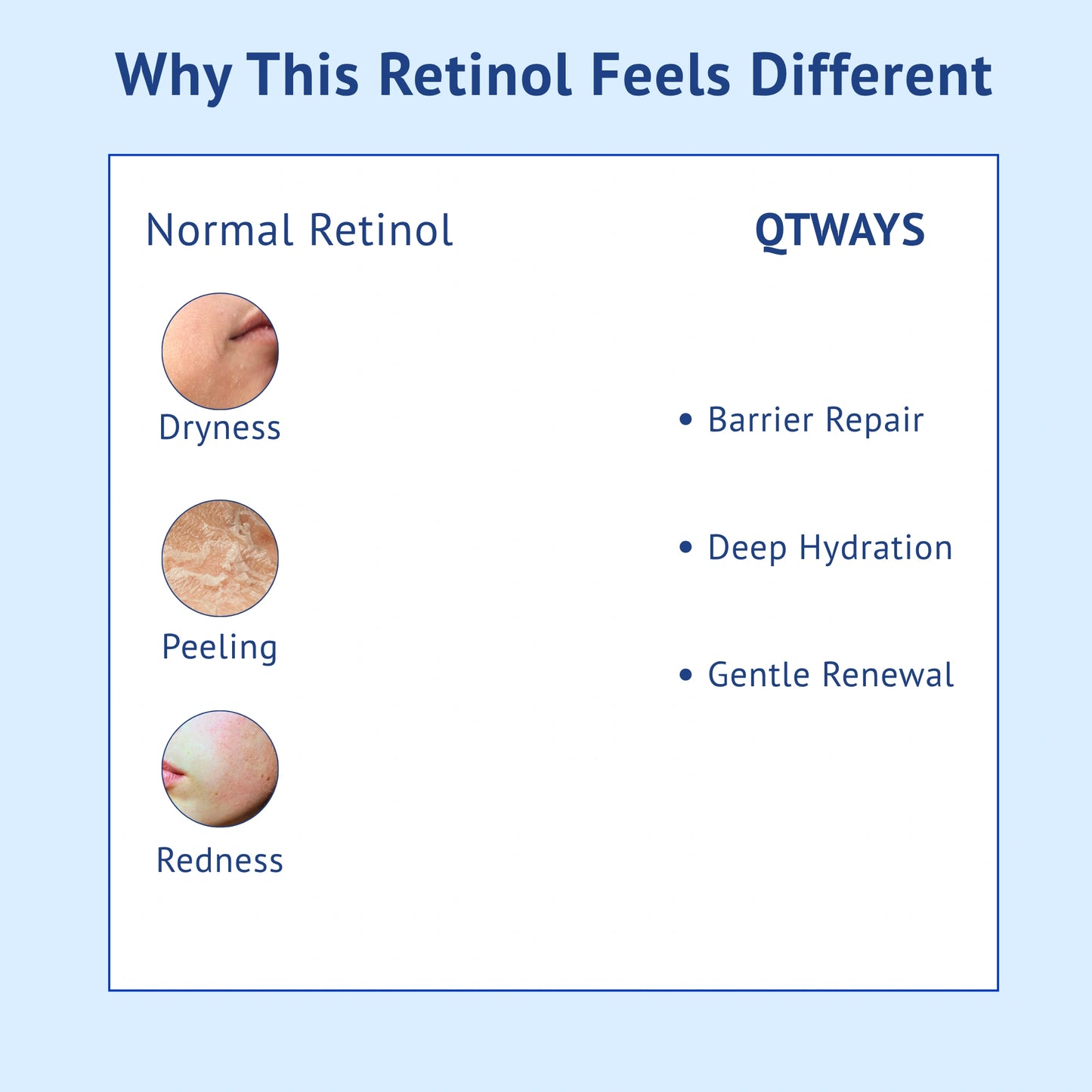 Comparison infographic titled Why This Retinol Feels Different for QTWAYS 0.3% Retinol Serum in India. It contrasts Normal Retinol side-effects (Dryness, Peeling, and Redness) against QTWAYS key benefits (Barrier Repair, Deep Hydration, and Gentle Renewal).