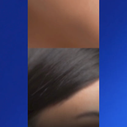 An Indian woman demonstrating how Qtways 0.3% Retinol Serum improves skin texture and reduces smile lines without causing irritation.