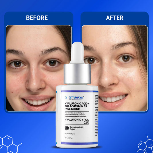 Before and after comparison showing improved skin hydration, smoother texture, enhanced radiance and healthier-looking complexion with Qtways Hyaluronic Acid, Polyglutamic Acid and Vitamin B5 Face Serum.