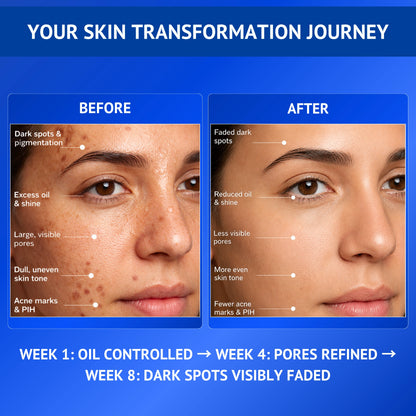 Before and after skin transformation infographic for Qtways 10% Niacinamide, 1% Kojic Acid and Vitamin B5 Face Serum showing reduction in dark spots, excess oil, visible pores, acne marks and post-inflammatory hyperpigmentation with improved skin tone over eight weeks.