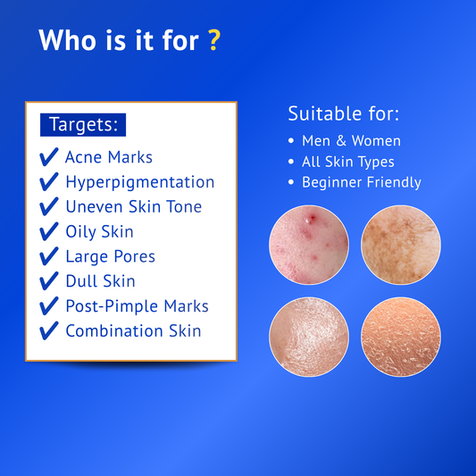 Infographic showing skin concerns targeted by QTWAYS 10% Niacinamide + 1% Kojic Acid + Vitamin B5 Face Serum, including acne marks, hyperpigmentation, uneven skin tone, oily skin, large pores, dull skin and post-pimple marks. Suitable for men and women and all skin types.