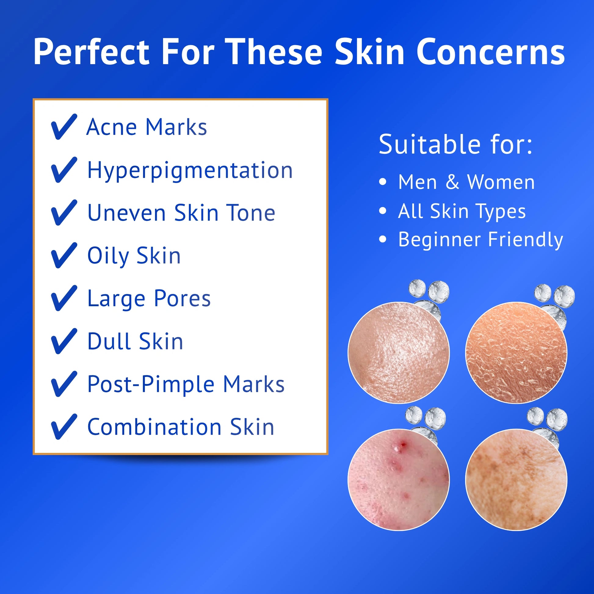 Infographic showing skin concerns targeted by QTWAYS 10% Niacinamide + 1% Kojic Acid + Vitamin B5 Face Serum, including acne marks, hyperpigmentation, uneven skin tone, oily skin, large pores, dull skin and post-pimple marks. Suitable for men and women and all skin types.