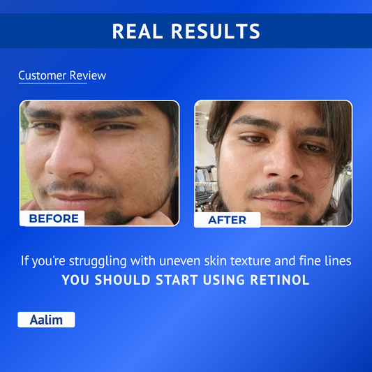 Before and after comparison showing smoother and refined skin texture after 4 to 8 weeks of using Qtways 0.3% Retinol Serum. Dermatologically tested anti-aging serum formulated with Retinol, Bakuchiol, Coenzyme Q10 and Vitamin E to improve skin texture and reduce visible signs of aging.