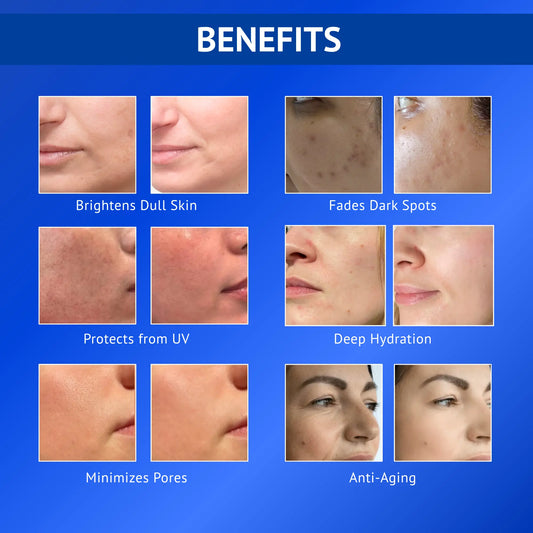 Benefits infographic for Qtways 10% Vitamin C and 0.5% Ferulic Acid Serum highlighting brighter skin, reduced dark spots, UV protection, deep hydration, minimized pores and anti-aging support for all skin types.