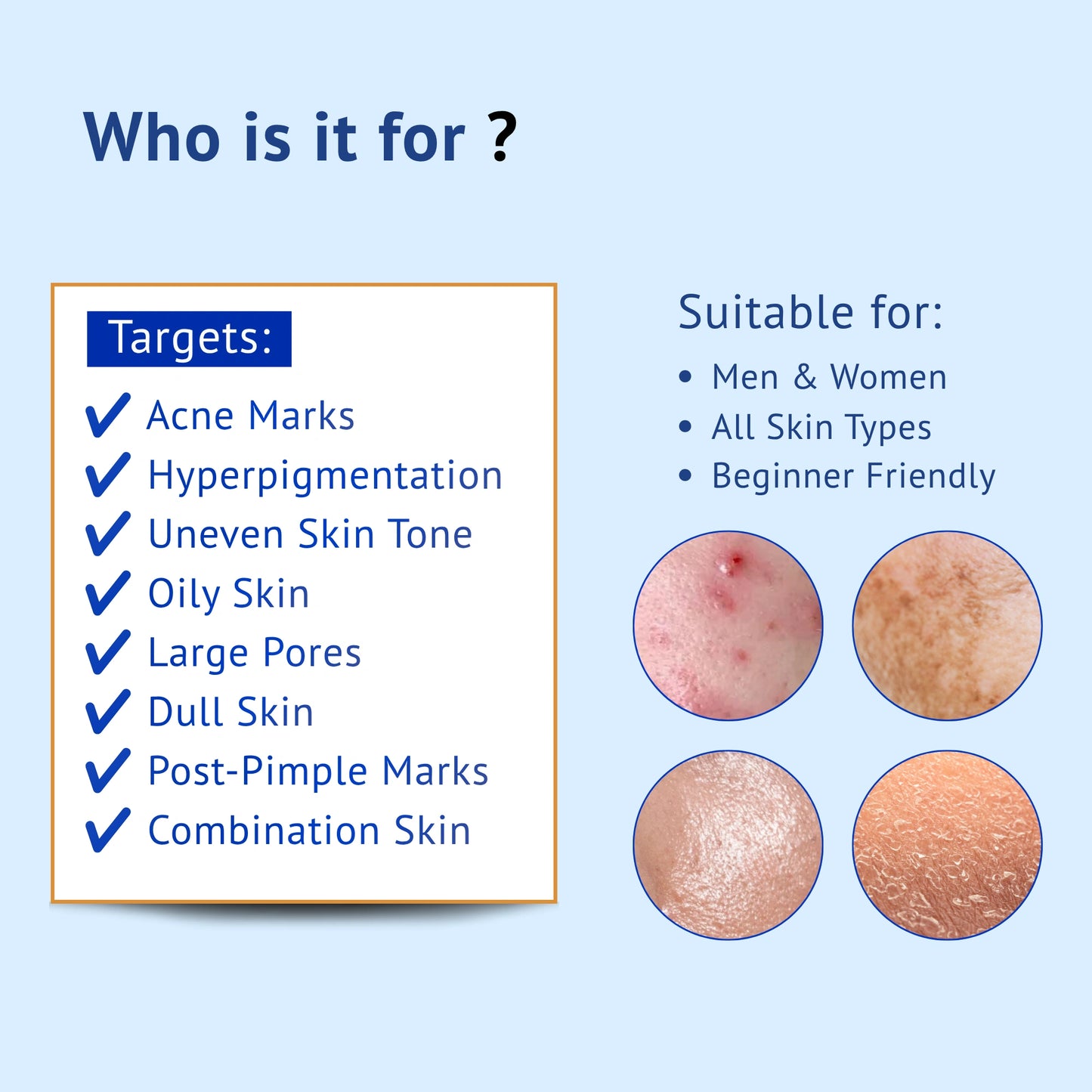 Infographic titled Who is it for? for QTWAYS Niacinamide + Kojic Acid & Vitamin B5 Face Serum in India. It lists target skin concerns including Acne Marks, Hyperpigmentation, Uneven Skin Tone, Oily Skin, Large Pores, Dull Skin, Post-Pimple Marks, and Combination Skin, stating it is suitable for Men & Women, All Skin Types, and is Beginner Friendly.