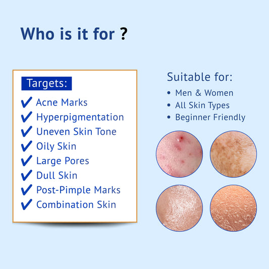 Infographic titled Who is it for? for QTWAYS Niacinamide + Kojic Acid & Vitamin B5 Face Serum in India. It lists target skin concerns including Acne Marks, Hyperpigmentation, Uneven Skin Tone, Oily Skin, Large Pores, Dull Skin, Post-Pimple Marks, and Combination Skin, stating it is suitable for Men & Women, All Skin Types, and is Beginner Friendly.