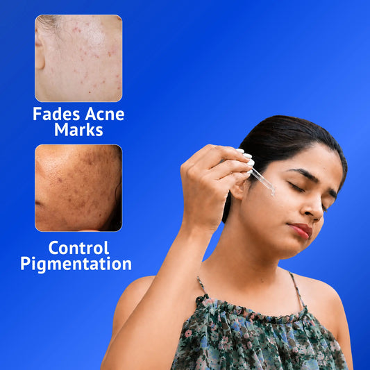 Woman applying QTWAYS 10% Niacinamide + 1% Kojic Acid + Vitamin B5 Face Serum with a dropper to help fade acne marks, control pigmentation, and improve overall skin clarity.
