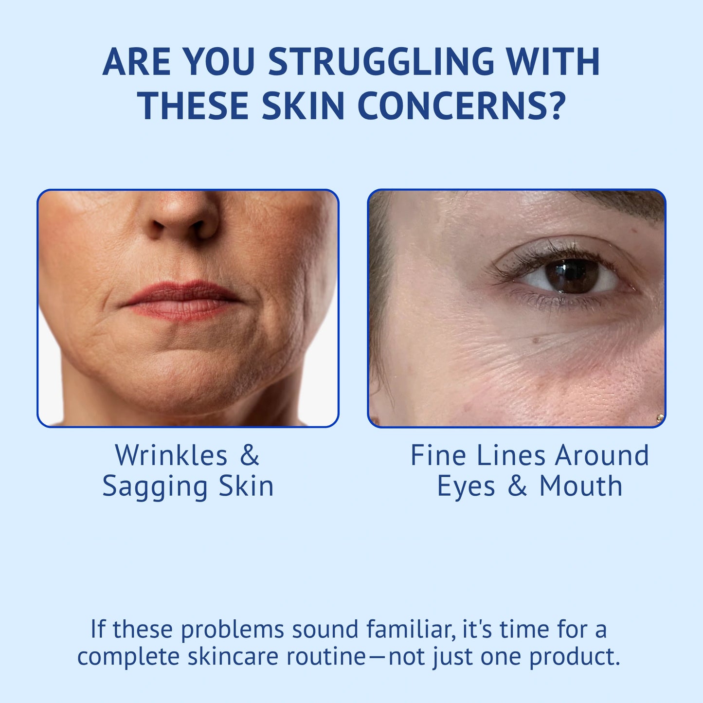 Problem-aware infographic titled Are You Struggling With These Skin Concerns? for QTWAYS Anti-Wrinkle Skincare Kit in India. It illustrates two major skin aging issues with close-up facial visuals: Wrinkles & Sagging Skin and Fine Lines Around Eyes & Mouth, with a callout recommending a complete skincare routine.