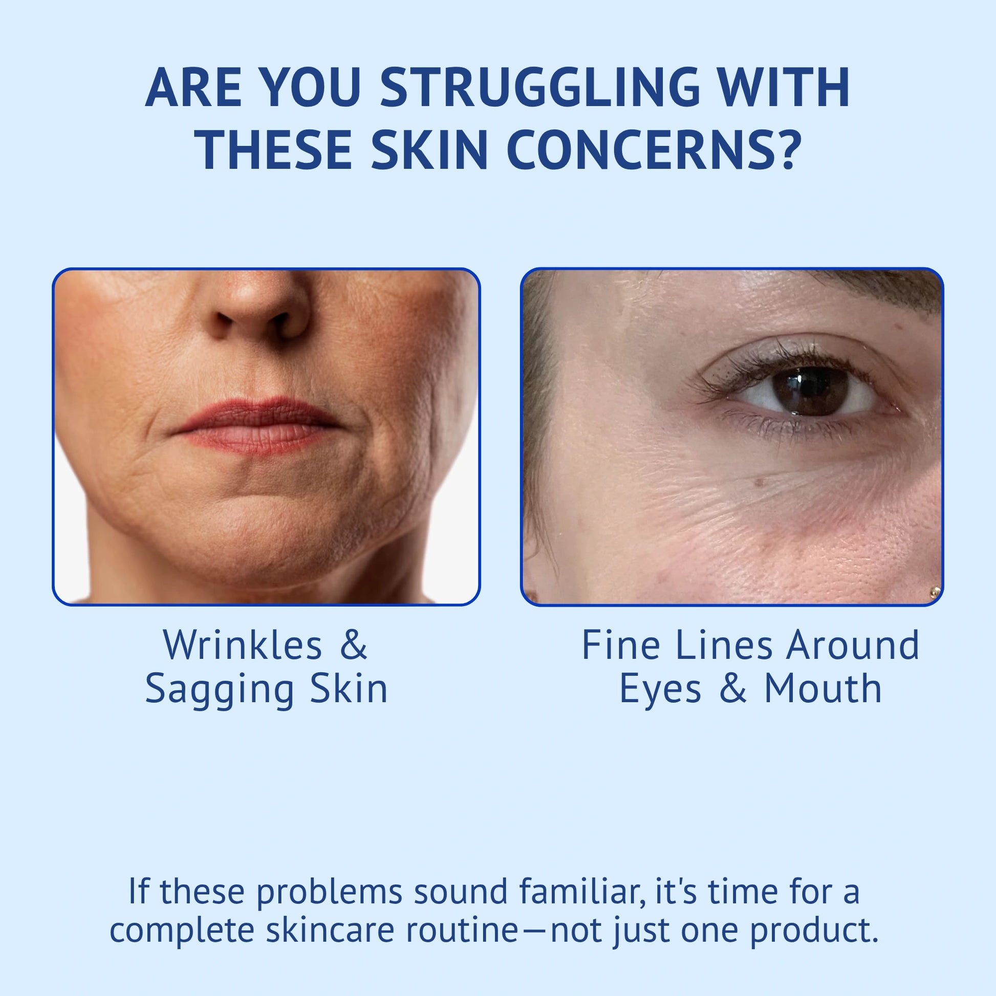 Problem-aware infographic titled Are You Struggling With These Skin Concerns? for QTWAYS Anti-Wrinkle Skincare Kit in India. It illustrates two major skin aging issues with close-up facial visuals: Wrinkles & Sagging Skin and Fine Lines Around Eyes & Mouth, with a callout recommending a complete skincare routine.